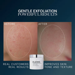 Skin Smoothing Pads Dynamic Resurfacing Facial Pads